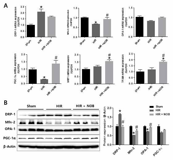 간장 허혈 및 재관류 손상 시 Nobiletin에 의한 미토콘드리아 모양 조절인자(DRP1, Mfn2, OPA1), 생 단백질(B)의 발현 변화를 분석함