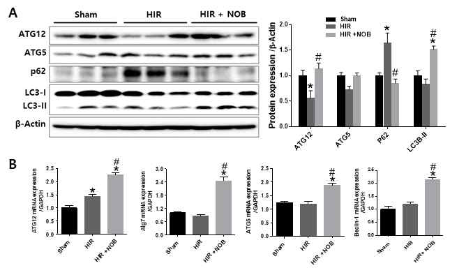 간장 허혈 및 재관류 손상 시 Nobiletin에 의한 자가포식 조절인자(ATGs, p62, LC3B)의 단백질(A), 유전자(B) 발현 변화 분석