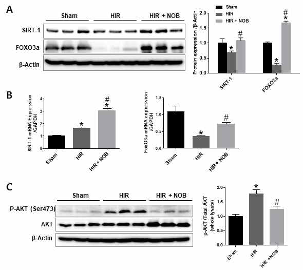 간장 허혈 및 재관류 손상 시 Nobiletin에 의한 SIRT1, FOXO3a 단백질(A), 유전자(B) 발현의 변화 및 활성조절효소 AKT 인산화 변화 분석(C)