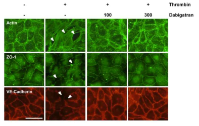 트롬빈에 의한 cytoskeleton 및 junctional protein 파괴에 대한 다비가트란의 보호 효과