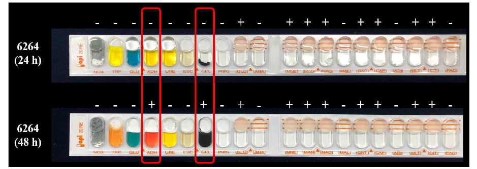 API kit의 결과. ADH (arginine dihydrolase)와 GEL (gelatin hydrolysis)의 활성이 24 시간과 48시간 경과 후에 서로 다르게 관측되었다