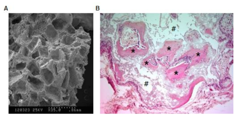 SEM image of porous bioceramic mixture of TCP and HA in 60:40. MSC (Left). seed bioceramic 8 week after implanted in Nude mouse (Right). New bone formation (*) observed in porous space (#) surrounded by decalcified area where ceramic occupied