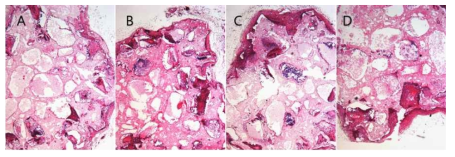 Microphotographs of ceramic cubes 8 weeks after transplantation into Nude mouse subcutaneously. Cube only cube (A), Hydrogel coating without BMP-2 (B), Hydrogel coating (C), and Hydrogel coating and cultured with steogenic inducing media (D)