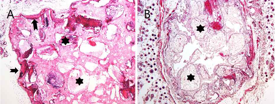 Microphotographs of ceramic cubes 8 weeks after transplantation into Nude mouse with mesenchymal stem cells before (A) and after differentiation induction (B). Arrows indicate capsular structure and stars indicate porous air cavity in ceramic cubes filled by new tissue or fluid