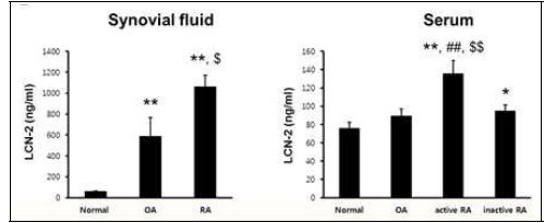 환자의 관절액(synovial fluid)과 혈청을 대상으로 LCN2의 농도를 ELISA를 통하여 확인. 정상 환자 (n=17), 골관절염환자 (n=20), 비활동성 RA관절염환자(n=22), 활동성 관절염환자(n=22) Values are the mean±SEM. *P<0.05, ** P<0.01 versus normal control; ##P<0.01 versus inactive RA patients; $P<0.05, $$P<0.01 versus OA patients