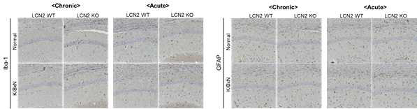 급성 및 만성 K/BxN 관절염 마우스의 hippocampus에서 Iba-1, GFAP의 발현변화는 미미함.→ 콜라겐 유도성 관절염 모델은 adoptive immune system이 주된 경로이고, K/BxN 관절염 마우 스 모델은 innate immune system이 주된 경로라서 두 개의 모델을 사용하고자 계획을 세웠는데, K/BxN 관절염 마우스 모델은 아마도 관절염 발생 기간이 너무 짧아서, 말단의 염증 발생이 중추신 경계인 뇌까지는 영향을 미치지 못한 것이라 생각됨