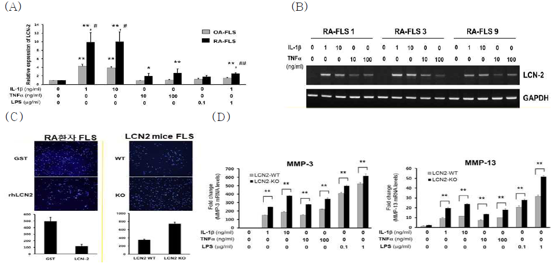 (A) 환자에게서 분리한 OA-FLS와 RA-FLS에 염증성 사이토카인인 IL-β, TNF-⍺, LPS를 농도별 처리한 후 culture media내 LCN2의 농도 증가(ELISA)와 (B) mRNA 발현 증가 (F) matrigel을 통한 invasion법에서 rhLCN2 처리에 의한 LCN2의 과발현은 RA환자의 FLS의 invasion을 억제하고 LCN2 KO 마우스 FLS의 invasion 증가 (G) LCN2 WT/KO마우스의 FLS에 염증성 사이토카인인 IL-β, TNF-⍺, LPS를 농도별로 처리하면 LCN2 WT 마우스의 FLS에 비해 KO마우스의 FLS에서 MMP-3, MMP-13의 mRNA의 발현이 증가. 결론적으로 LCN2는 RA-FLS의 invasion 을 억제함을 증명함