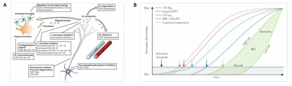 알츠하이머병의 뇌내 환경을 반영하는 뇌척수액(A) 및 뇌척수액을 활용한 진단(B)