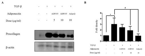 Effect of ADP355 on transforming growth factor 1-induced procollagen expression. Treatment of ADP355 (5 and 10 g/mL) and adiponetin recombinant, AdipoQ(10 g/mL), simultaneously with TGF-1 10g/mL of ADP355 and AdipoQ, attenuated TGF-1-induced procollagen expression. (A) Western blot analysis results. (B) Quantification of western blot results(*p 0.05, control vs. TGF-1, # p 0.05, TGF-1 vs. TGF-1 + ADP355, and TGF-1 vs. TGF-1 + AdipoQ). The data are expressed as mean SD. Representative data are shown from three independent experiments