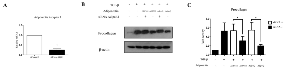 Knockdown of adiponectin receptor 1 (AdipoR1) reversed the ADP355 attenuation of TGF-1-induced collagen expression. The effect of adiponectin receptor knockdown was compared with that of a negative control siRNA(A, * p 0.05) Knockdown of AdipoR1 reversed the procollagen expression attenuation by ADP355 and adiponectin recombinant, AdipoQ(B, C, * p 0.05). The data are expressed as mean SD. Representative data are shown from three independent experiments