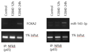 F2840 처리 전과 후 (12hr, 24hr)에 NKfB항체로 면역 침강 시킨 DNA 추출물을 FOXA2 와 miR-143-3p의 promoter의 primer를 이용하여 ChIP assay 결과. 1% in put 으로 동량의 DNA검증