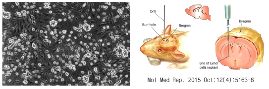 Rat glioma cell인 C6 cell (좌)와 동물의 Brain 내 종양이식 모식도 (우)
