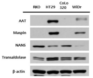 KRAS wild type colon cancer cell에서의 핵심인자들의 발현변화 분석