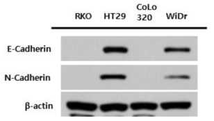 KRAS wild type colon cancer cell line에서 암전이 연관 단백질의 발현양 비교