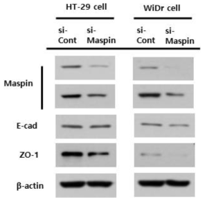 Maspin발현 억제에 따른 전이연관 단백질 발현 분석