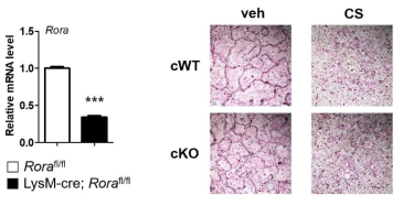 wild-type (floxed mouse) 과 ROR-alpha conditional knockout primary osteoclast에 cholesterol sulfate 처리 후 분화 양상 평가. 좌측. Rora gene qPCR 결과. 우측. RANKL induced osteoclastogenesis 평가