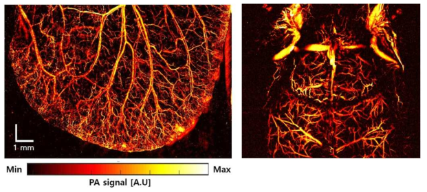 광해상도 광음향 현미경을 이용한 마우스의 귀 및 뇌 미세혈관 촬영 결과