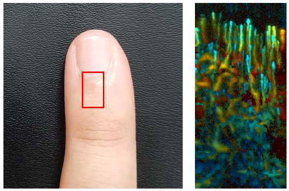 음향해상도 광음향 현미경을 이용한 사람 손바닥 혈관 영상 결과