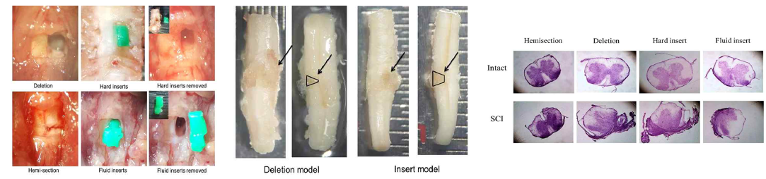 4 type models for mouse spinal cord injury (left). Volume measurements of SCI models (middle). H&E stained tissue for Measurement of injury volume (right)