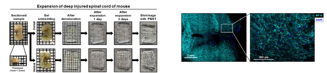 Expansion process and expanded injured mouse spinal cord (left) by MAP. High resolution images (right) using LSM880 confocal microscopy and IMARIS software. Neurofilament (blue green), DAPI (blue)