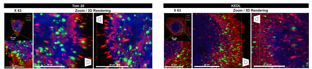 (좌) Ara-27-FITC peptide가 transduction된 293T 세포를 Optimized-Cell-MAP 이후 고해상도 삼차원적 이미지로 분석한 결과 (Tom 20(Red)과 DAPI(Blue) 염색). (우) Ara-27-FITC peptide가 transduction 된 293T 세포를 Optimized Cell-MAP 이후 고해상도 삼차원적 이미지로 분석한 결과 (KEDL (Red)과 DAPI (Blue) 염색)