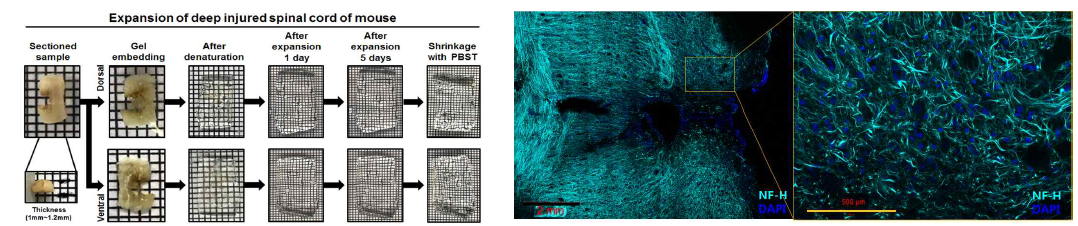 척수손상 Mouse 모델을 대상으로 최적화된 조직확대투명화 기술. (좌) Mouse defected spinal cord를 이 용한 조직확대투명화 과정. (우) 조직확대투명화된 Mouse defected spinal cord 조직을 Neurofilament (Mint)와 DAPI (Blue) 염색 후 얻은 초고해상도 이미지. 10 배율의 (200μm) Tile scan 이미지와 (500μm) Zoom 초고해상도 이미지