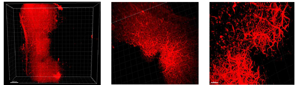 (좌) Lectin (594) (Red) 염색 후 얻은 초고해상도 3D rendering 이미지 (0.63 배율, Bar : 200μm). UltraMicroscope (LaVisionBioTec)을 이용하여 조직확대투명화된 Mouse defected spinal cord 조직의 초고해상도 이미징 분석 결과. (중, 우) Lectin (594) (Red) 염색 후 defect 부분을 focus한 초고해상도 3D rendering 이미지 (0.63 배율)