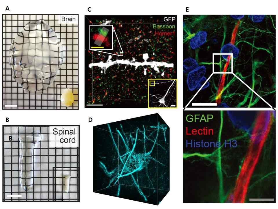 MAP (Magnified Analysis of Proteome) 을 이용 한 결과들. MAP 적용 후 4배 이상 조직확대투명화가 이루어진 mouse 뇌(A)와 척수 (B). MAP 적용 후 획득한 다양한 초 고해상도 이미지들. Dentritic spine 끝에 위치한 시냅스 (C), NF-H 염색 후 확인한 fine cytoskeletal structure (D), GFAP 염색하여 확인한 성상세포 (Astrocyte)가 혈관 (Lectin) 근처에 분포하는 초고해상도 이미지 (E)