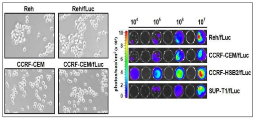 f-Luciferase 도입 ALL 백혈병 안정세포주 구현