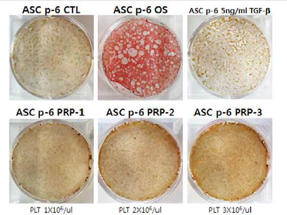 2일마다 배양액 교체, CTL : Control, OS : Osteogenesis 분화유도, TGF-beta농도 : 5ng/ml, PLT(혈소판)농도 : PRP-1(1X10⁶/ul), -2(2x10⁶/ul), -3(3x10⁶/ul), 분화기간 : 21일)