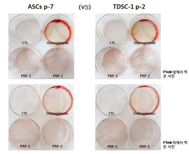 종전에 사용했던 ASC 줄기세포와 분리한 TDSC 줄기세포에서 osteogenesis 유도배지에서는 분화가 되고 있음을 Alizarin-red stain을 통해 알 수 있었음. 그러나, PRP 농도 1(1X106/ul)과 농도 2(2X106/ul)에는 분화가 되지 않았음. (왼쪽 사진은 종전에 사용했던 ASC 줄기세포를 사용한 것, 오른쪽 사진은 건조직에서 분리한 줄기세포 TDSC를 사용한 것)