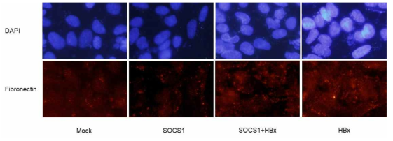 SOCS1의 의해 ECM의 구성성분인 fibronectin의 deposition이 감소되는 것과 HBx에 의해 다시 증가되는 것을 확인하였다