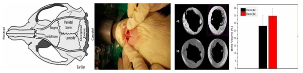 난소적출모델의 두개골 결손(좌), Micro-CT Bone volume 측정(우)