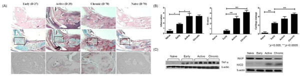 콜라겐 유도 관절염 (CIA) 마우스 모델의 관절에서 질환 시기별 RKIP의 발현 양상 분석 및 Notch 1 (NICD)의 연관성 평가 (A) CIA 마우스 모델의 관절에서 질환 시기별 H **, p<0.005; ***, p<0.0005 vs. Naive (D70)