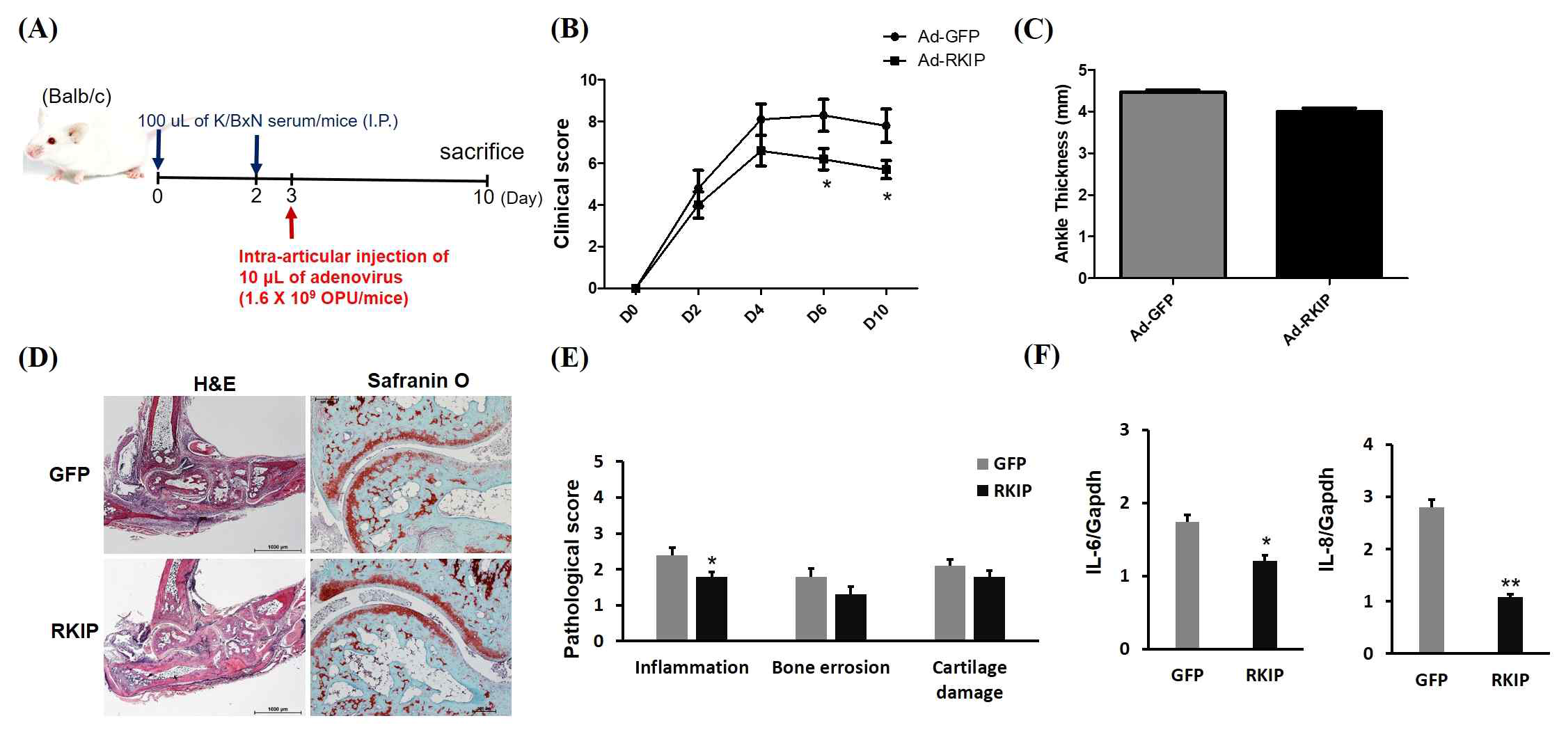 K/BxN 관절염 마우스 모델에서 RKIP 아데노바이러스의 관절염 치료효과. (A)동물 실험 일정 (B) 임상 (C) 발목두께 측정 (D) H&E, TRAP staining 대표사진 (E) 뒷발의 병리학적 점수 (F) 사이토카인 (IL-1b, IL-6) mRNA 발현양 측정