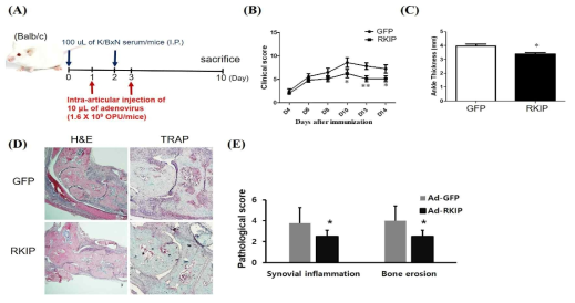 K/BxN 관절염 마우스 모델에서 RKIP 아데노바이러스의 관절염 예방효과. (A)동물 실험 일정 (B) 임상 점수 (C) 발목두께 측정 (D) H&E, TRAP staining 대표사진 (E) 뒷발의 병리학적 점수 (F) 사이토카인 (IL-1b, IL-6) mRNA 발현양 측정