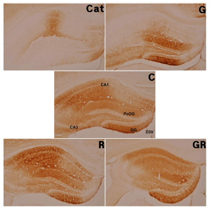 Eeffect of Ginseng Radix and Rehmanniae Radix extracts on β-amyloid-positive cells in the hippocampus C : Control Group, Cat : Catalpol Group, G : Ginseng Group, R : Rehmanniae Group, GR : Ginseng & Rehmanniae Group CA1 : Cornu Ammonis Area 1, CA3 : Cornu Ammonis Area 3 DG : Dentate Gyrus, PoDG : Polymorphic layer of the Dentate Gyrus D3V : Dorsal 3rd Ventricle