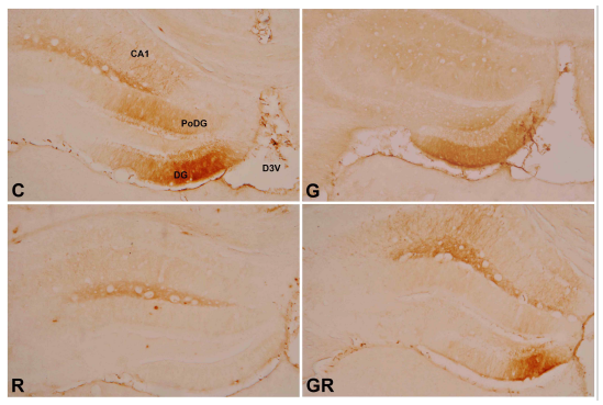 Photomicrograph on expression of β-amyloid-positive cells in the hippocampus of B6C3-Tg mice (β-amyloid immunohistochemistry, ×50). C, Control Group; G, Ginseng Group; R, Rehmanniae Group; GR, Ginseng & Rehmanniae Group. CA1 : Cornu Ammonis Area 1, D3V : Dorsal 3rd Ventricle DG : Dentate Gyrus, PoDG : Polymorphic layer of the Dentate Gyrus