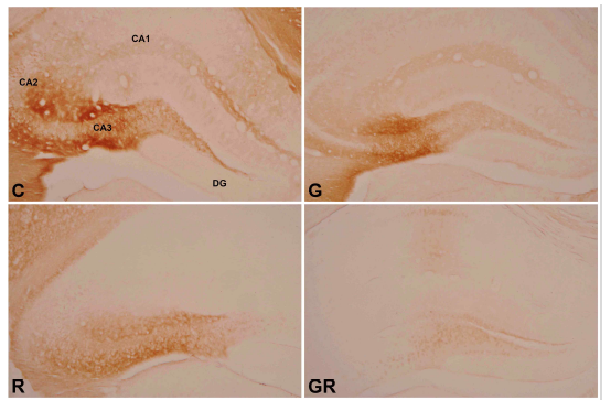 Photomicrograph on expression of Tau-protein-positive cells in the hippocampus of B6C3-Tg mice (Tau immunohistochemistry, ×50). C, Control Group; G, Ginseng Group; R, Rehmanniae Group; GR, Ginseng & Rehmanniae Group. CA1 : Cornu Ammonis Area 1, CA2 : Cornu Ammonis Area 2 CA3 : Cornu Ammonis Area 3, DG : Dentate Gyrus