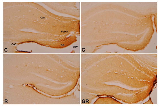 Photomicrograph on expression of CD68-positive cells in the hippocampus of B6C3-Tg mice (CD68 immunohistochemistry, ×50). C, Control Group; G, Ginseng Group; R, Rehmanniae Group; GR, Ginseng & Rehmanniae Group. CA1 : Cornu Ammonis Area 1, CA3 : Cornu Ammonis Area 3 DG : Dentate Gyrus, PoDG : Polymorphic layer of the Dentate Gyrus D3V : Dorsal 3rd Ventricle