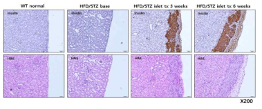 신장막에 이식한 췌장도세포 insulin과 H&E 염색 관찰 (x200)