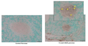 9주령 B6-db/db mouse 췌장조직의 tunnel 염색. (yellow arrow: apoptotic cell)