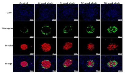 B6 db/db mouse의 췌장도세포의α-cell(glucagon, green) β-cell(insulin, red) 염색