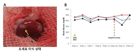 2형 당뇨병 쥐에 정상 췌장도세포 이식 후 생존율 분석 (A) kidney capsule에 췌장도세포 이식 (B)이식 후 혈당 관찰