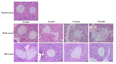 db/db mouse와 HDF mosue의 주령에 따른 췌장도세포의 변화 관찰 (H&E 염색, x200)