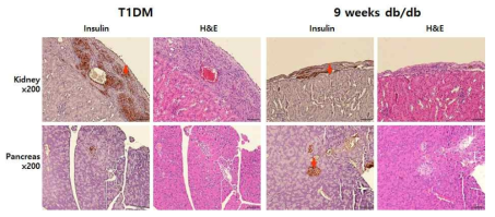 췌장도세포 이식 1주일 후 신장을 적출하여 insulin 항체를 이용한 IHC와 H&E 염색. 1형 당뇨쥐와 2형 당뇨쥐의 신장막에 insulin을 분비하는 췌장도세포가 관찰됨.1형 당뇨쥐와는 달리 2형 당뇨쥐의 췌장에서도 insulin을 분비하는 췌장도세포가 관찰됨.(화살표: insulin 항체에 양성인 췌장도세포)