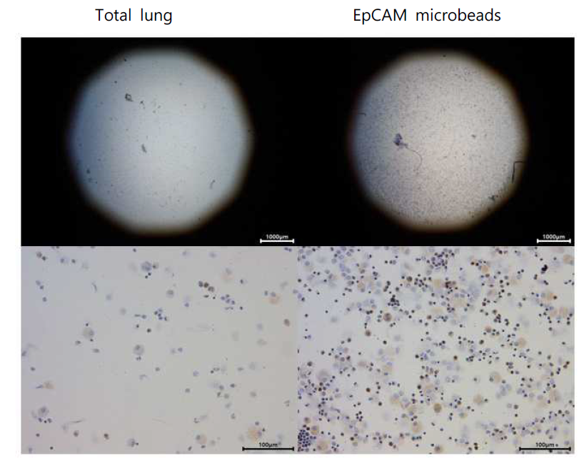 폐조직으부터 폐 성체줄기세포인 hATIIs의 MACS 분리효율 비교 및 세포 면역염색 확인(proSP-C)