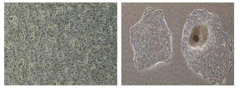 제 II형 폐포세포(hATIIs)와 제 II형 폐포세포(hATIIs) 유래의 인간 iPSCs