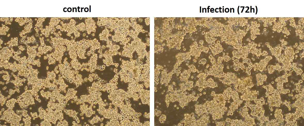 virus infection후 cell phenotype