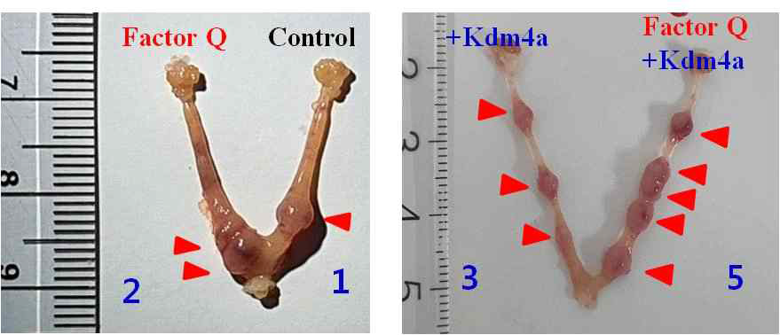 기증자 세포에 Endothelin-1처리, kdm4a mRNA 주입 후 복제배아의 착상효율 검증